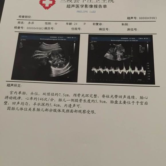 加油还有84天预产期，在家好无聊啊，快解放了84天就生了。